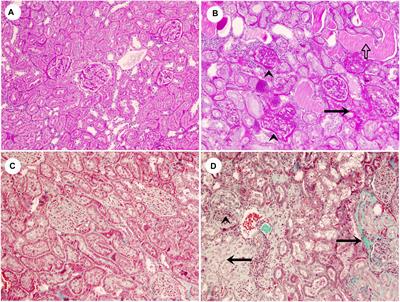 Klotho and Aminopeptidases as Early Biomarkers of Renal Injury in Zucker Obese Rats